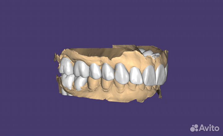 Зубной техник. Коронки, Виниры (Емах, Циркон)