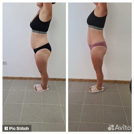 Lpg-массаж, rf-лифтинг, кавитация, прессотерапия