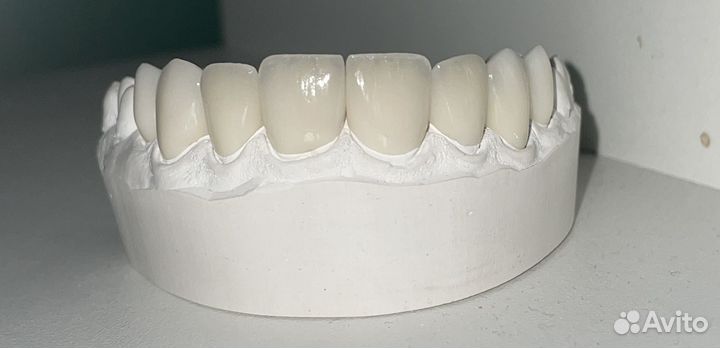 Зубной техник. Коронки, Виниры (Емах, Циркон)