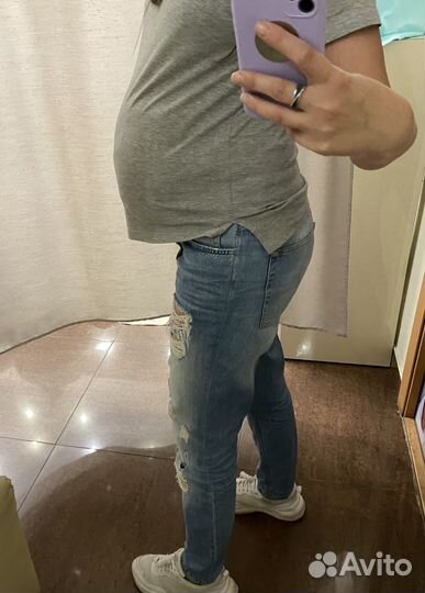 Накладной живот