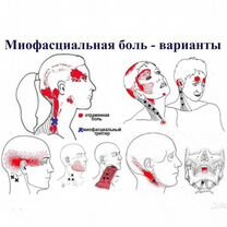 Оздоровительный массаж тела, миопрессура, триггеры, Уфа