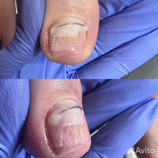 Подолог/педикюр для пожилых людей