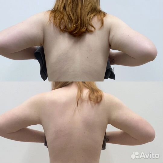 Массаж коррекция фигуры