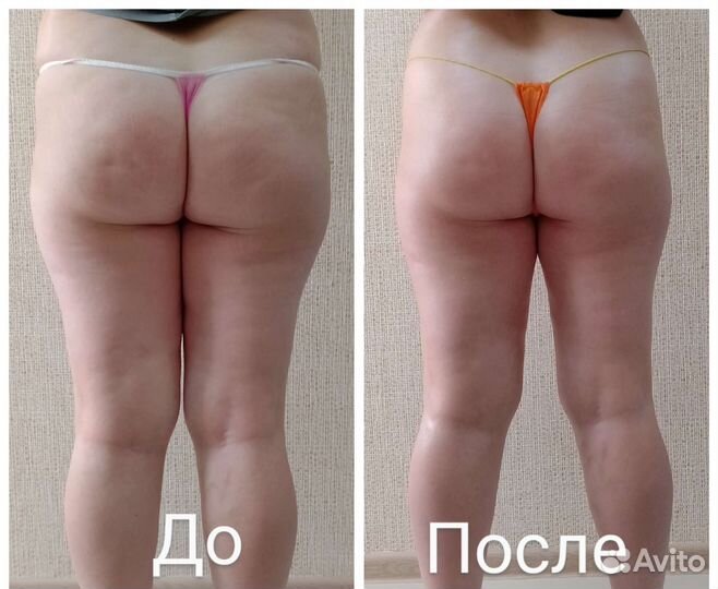 Аппаратная коррекция фигуры, общий вибромассаж