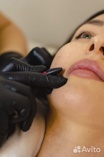 Электроэпилятор Микротерм Обучение Микро-терм