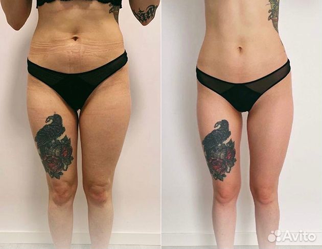 Модель на LPG