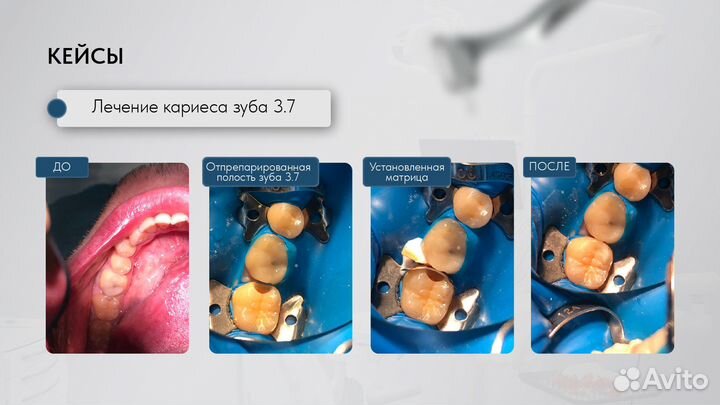 Врач стоматолог терапевт