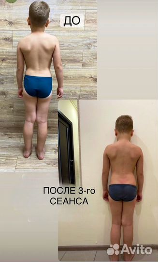 Массаж / остеопат / костоправ