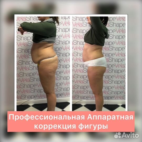 Массаж Похудение Коррекция фигуры Косметолог