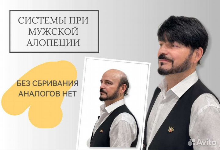 Система замещение для волос