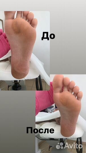 Подолог педикюр