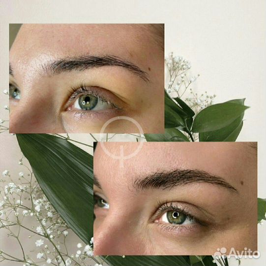 Восстановление роста волос бровей за 4 процедуры