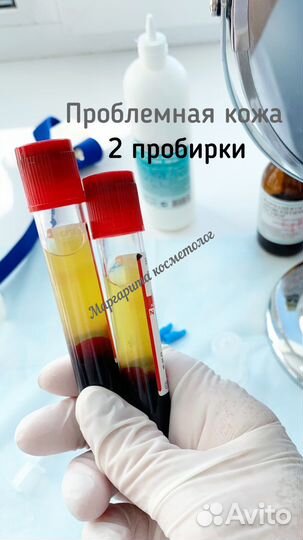 Косметолог/Челны/Плазмолифтинг/Плазмогель