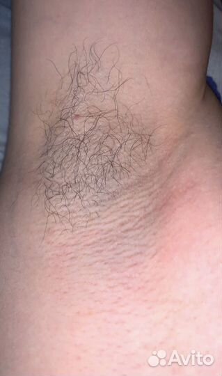 Восковая депиляция