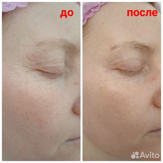 Ионный массажер fohow для ухода за кожей лица