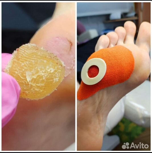 Подолог/Педикюр/Выезд возможен