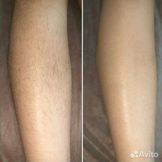 Бикини-дизайн