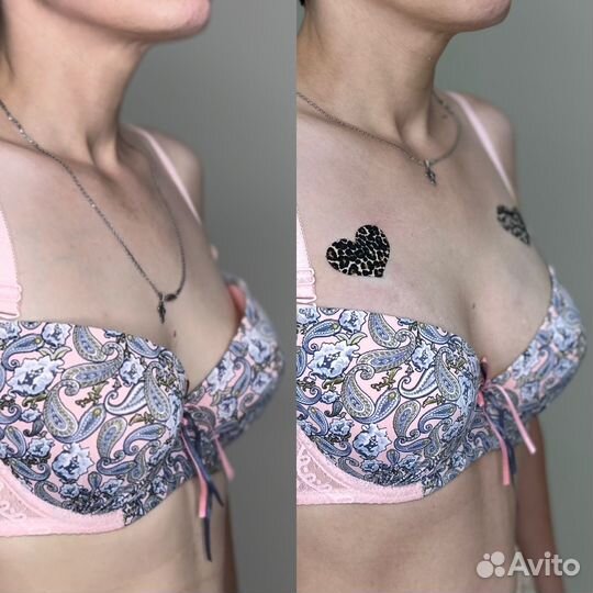 Увеличение ягодиц/ груди/ интимная пластика