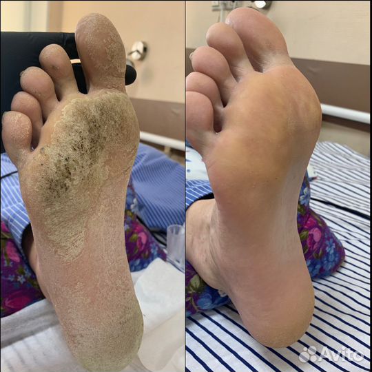 Подолог. педикюр. маникюр