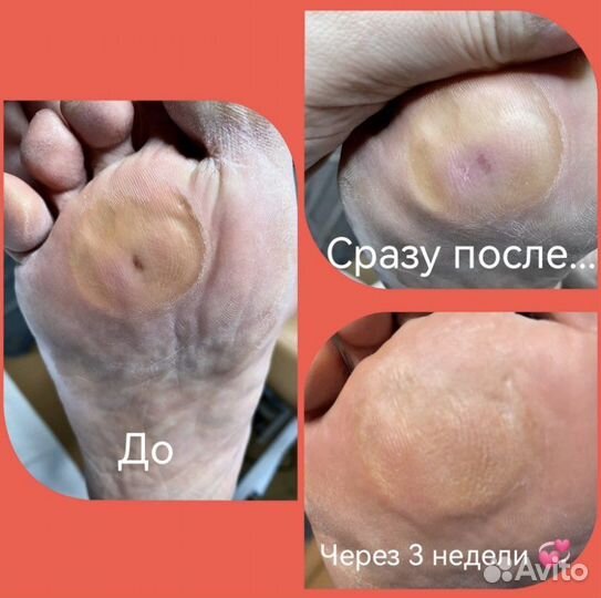 Педикюр/маникюр