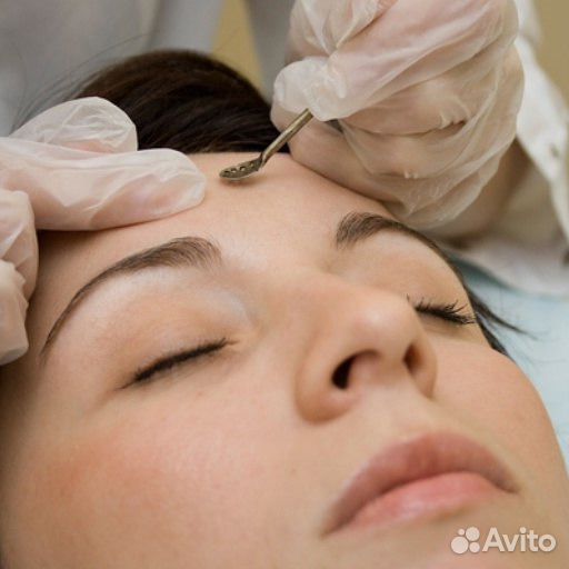 Консультация косметолога