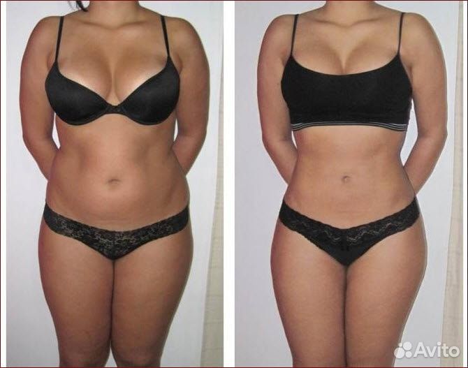 Модель на LPG