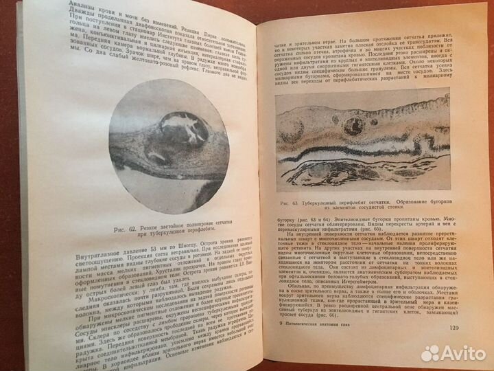 Книги по офтальмологии СССР