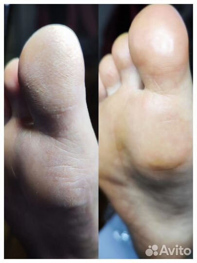 Смарт педикюр. Метро звёздная