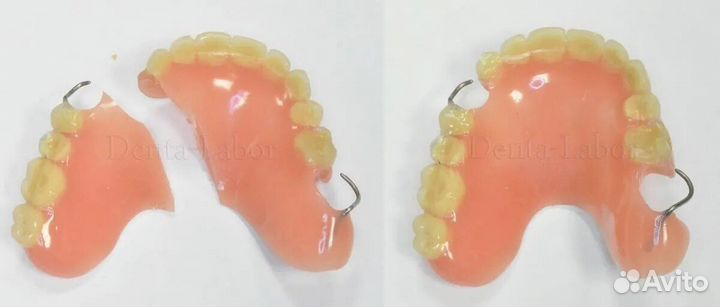 Ремонт,починка зубного протеза