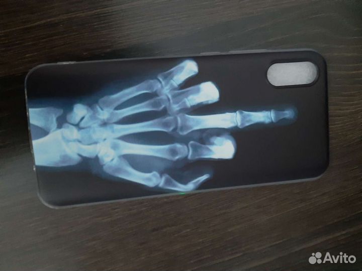 Чехол на Xiaomi redmi 9a