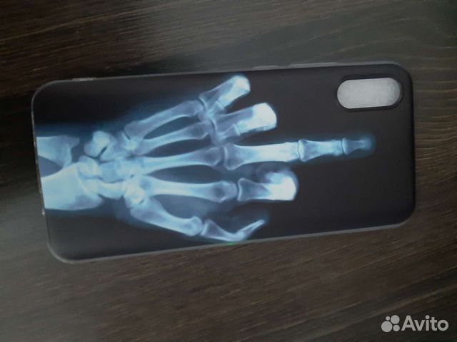 Чехол на Xiaomi redmi 9a