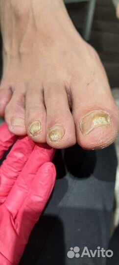 Услуги подолога