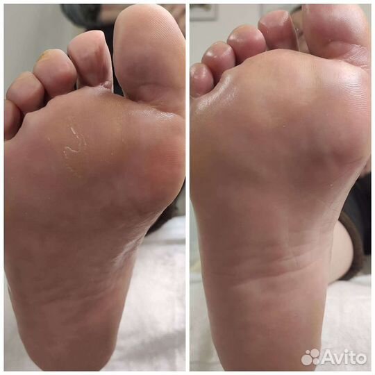 Подолог + мастер педикюра (лечебный и эстетический