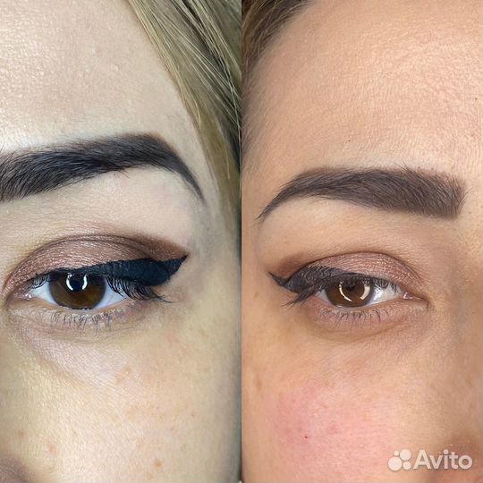 Косметолог избербаш