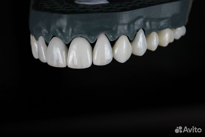 Зуботехническая лаборатория Моделирование Exocad