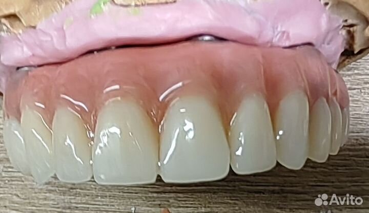 Съемные зубные протезы