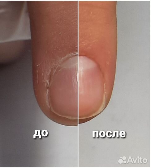 Маникюр- пилочный/ педикюр/ подолог