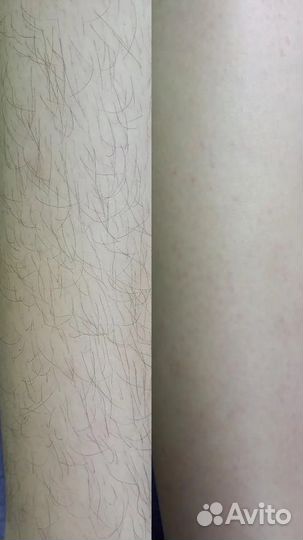 Шугаринг Депиляция Воском