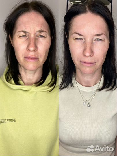 Услуги косметолога в Калининграде