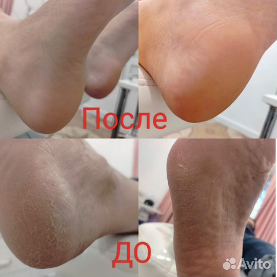 Маникюр, наращивание ногтей