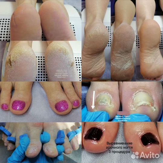 Маникюр и педикюр с выездом на дом к клиенту