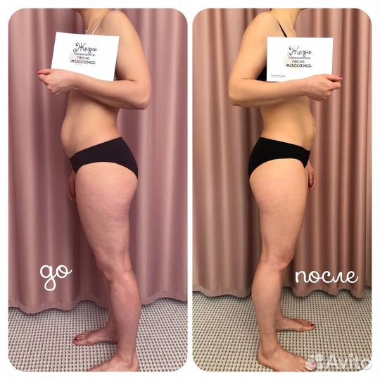 Скульптурирующий массаж