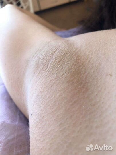 Депиляция шугаринг косметолог-эстетист