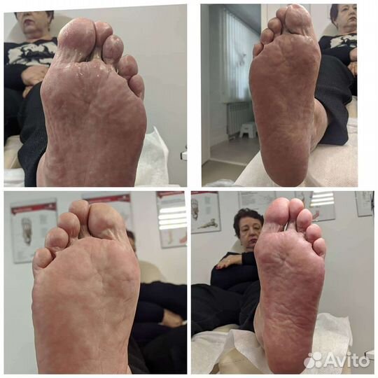 Подолог + мастер педикюра (лечебный и эстетический