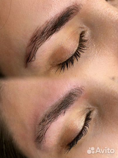 Удаление татуажа