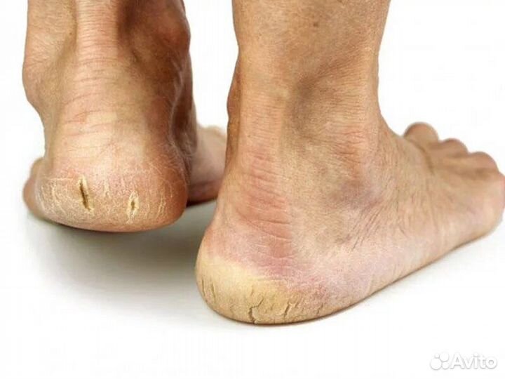 Модель на педикюр