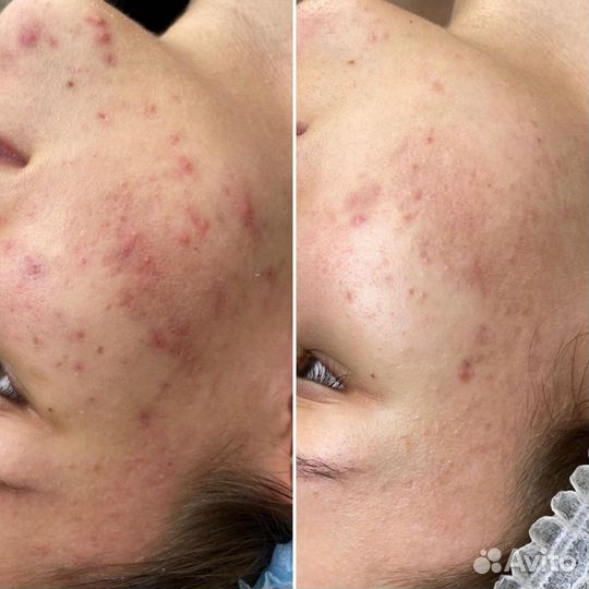 Косметолог с мед. образованием