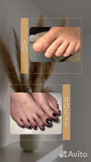 Мастер Педикюра