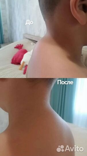 Массаж на дому