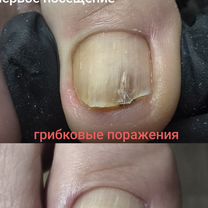 Подологический педикюр, Зеленоград